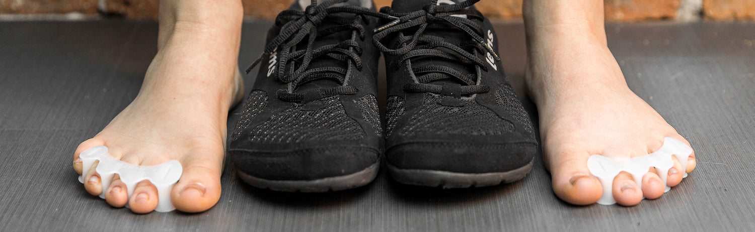 Understanding Bunions: Causes, Symptoms, & Treatment